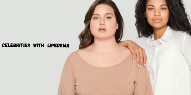 celebrities with lipedema