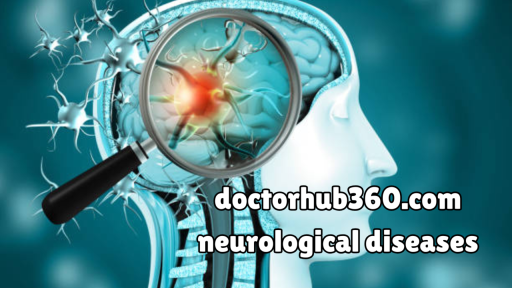 doctorhub360.com neurological diseases